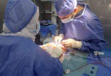 عملية نادرة تنقذ رضيعة عمرها 20 يومًا من نزيف بالمخ في مستشفى دمياط العام