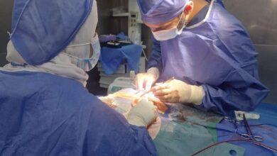 عملية نادرة تنقذ رضيعة عمرها 20 يومًا من نزيف بالمخ في مستشفى دمياط العام