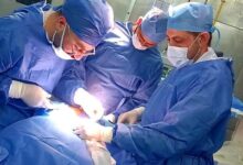 “إنقاذ سيدة 60 سنة من نزيف حاد بالمخ بمستشفى دمياط العام”